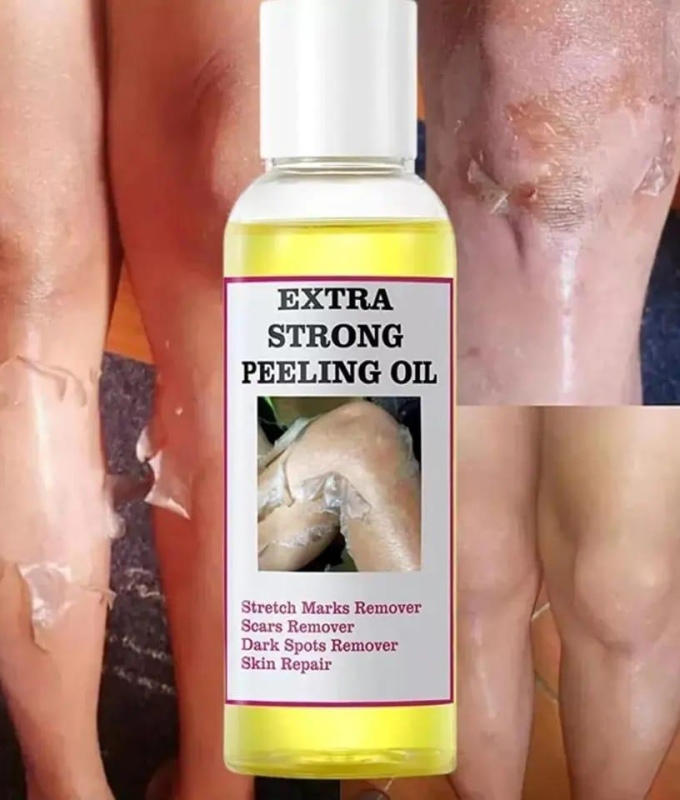 Extra Strong Peeling Oil